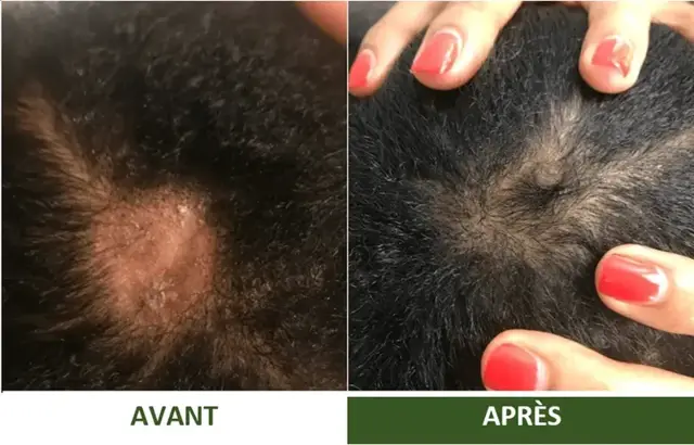 Avant et après d'une cliente Varosia