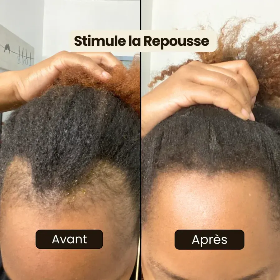 Avant et après : résultat partagé par une cliente